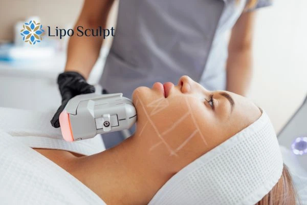HIFU vs Botulinum Toxin: Understanding the Differences 1 HIFU vs Botox Bradford on Avon What is the best option for you?