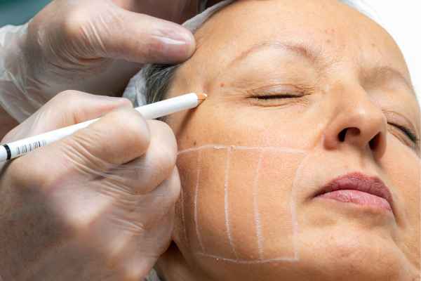 CryoPen: 5 Skin Concerns It May Be Used to Treat 4 What should you ask before having CryoPen treatment Bradford on Avon?
