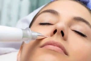 Best Actinic Keratoses Removal 3 Actinic keratoses Bradford on Avon solutions - book in today!