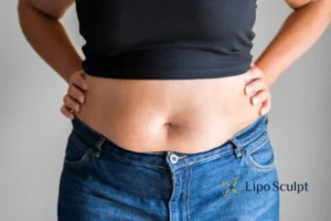 Bidding Farewell to Muffin Tops with Aqualyx Fat Injections 2 Do you wish you could reduce your muffin top Bradford on Avon With Aqualy fat dissolving injections you can!