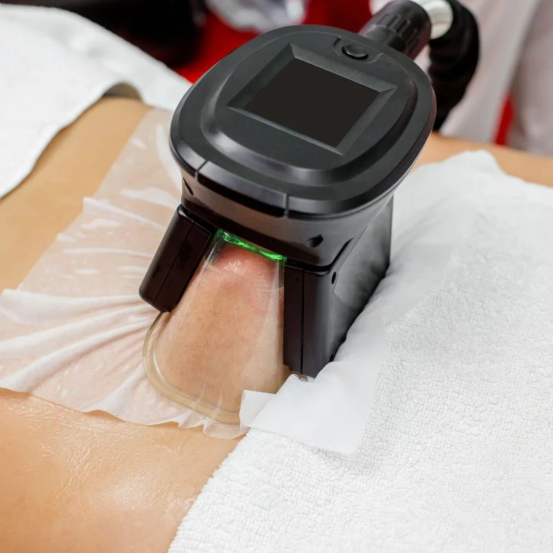 Fat Freezing treatment Bradford on Avon